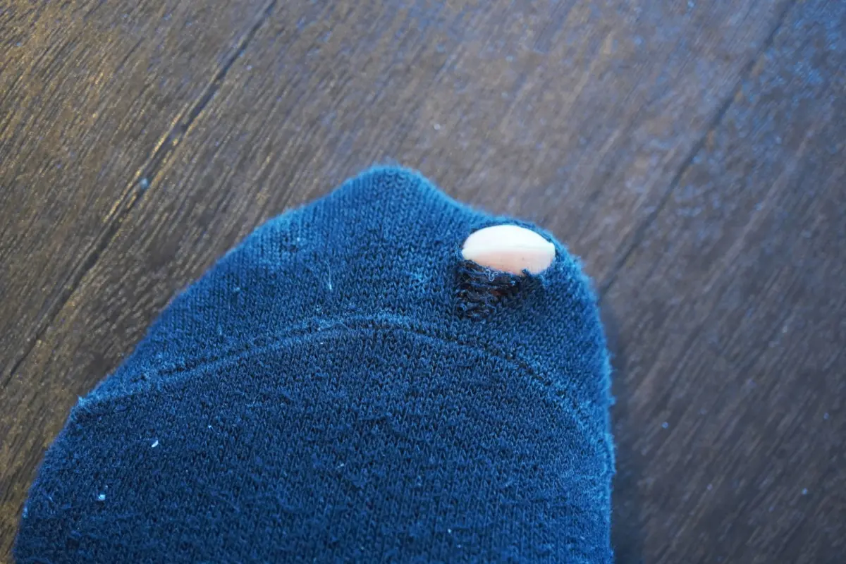 A sock with a visible hole, symbolizing an unexpected moment of embarrassment.